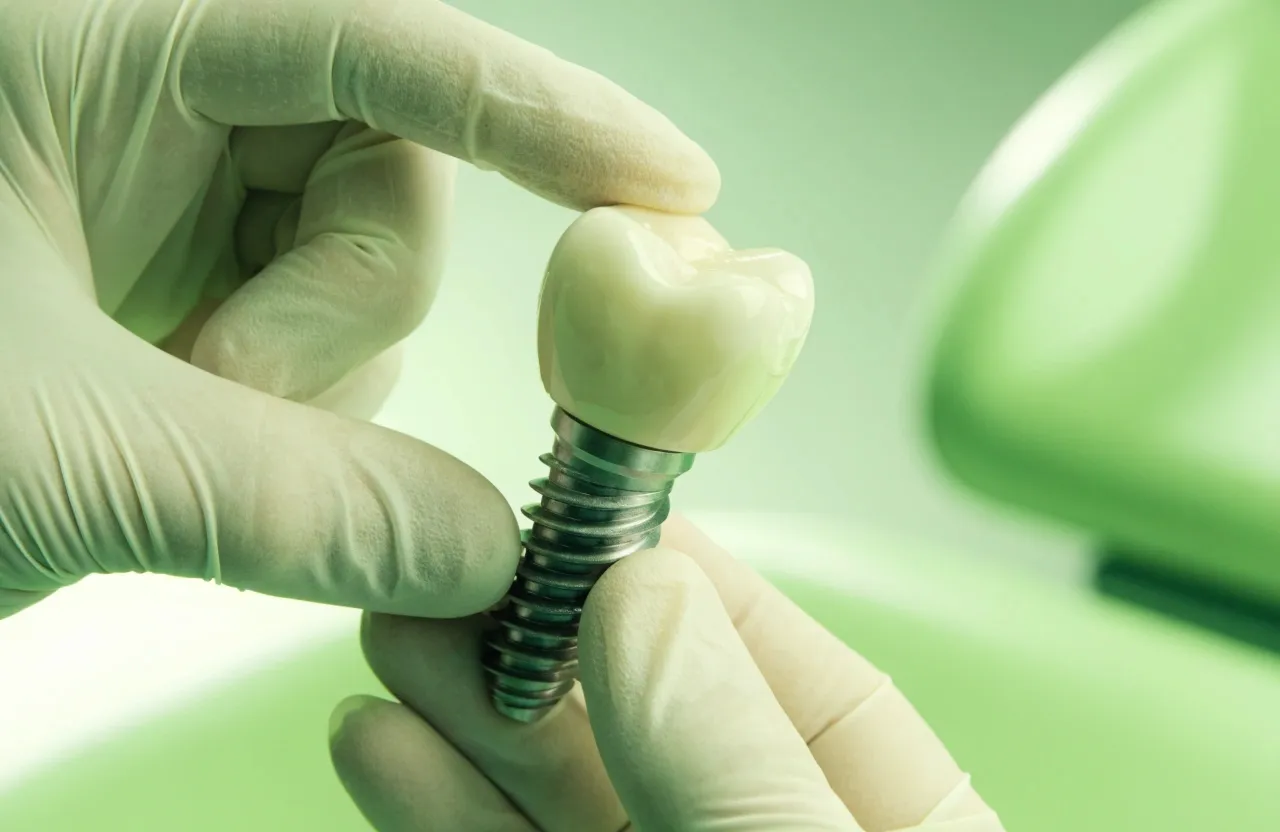Mãos do dentista mostrando o implante dentário